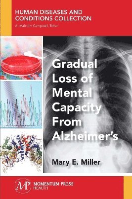 bokomslag Gradual Loss of Mental Capacity from Alzheimer's