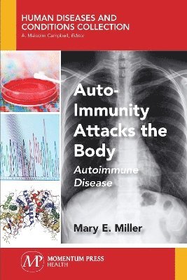 Auto-Immunity Attacks the Body 1