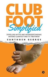 bokomslag Clubfoot Simplified: Dispelling Myths and Misunderstanding around Clubfoot and its treatment