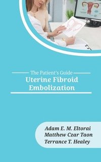 bokomslag Uterine Fibroid Embolization