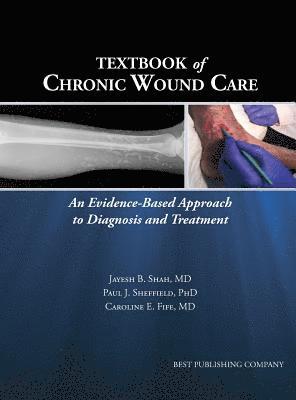 bokomslag Textbook of Chronic Wound Care