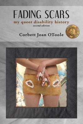 Fading Scars: My Queer Disability History, 2nd Edition 1