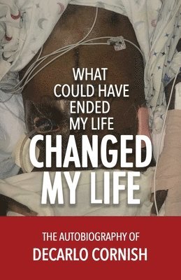 What Could Have Ended My Life Changed My Life 1