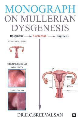 bokomslag Monograph on Mullerian Dysgenesis