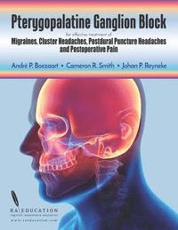 bokomslag Pterygopalatine Ganglion Block: for effective treatment of Migraine, Cluster Headache, Postdural Puncture Headache & Postoperative Pain