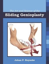bokomslag The Art and Science of the Sliding Genioplasty
