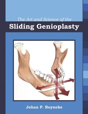 The Art and Science of the Sliding Genioplasty 1