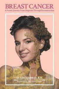 bokomslag Breast Cancer