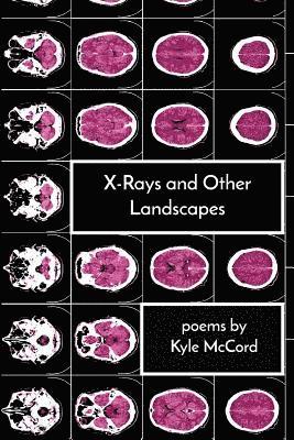 X-Rays and Other Landscapes 1