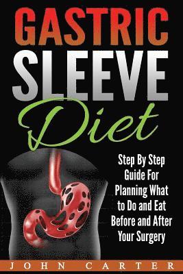 Gastric Sleeve Diet