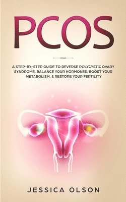 bokomslag Pcos