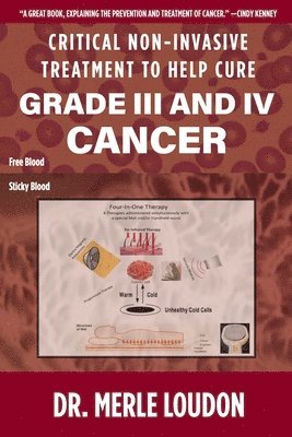 bokomslag Critical Non-Invasive Treatment to Cure Grade III and IV Cancer