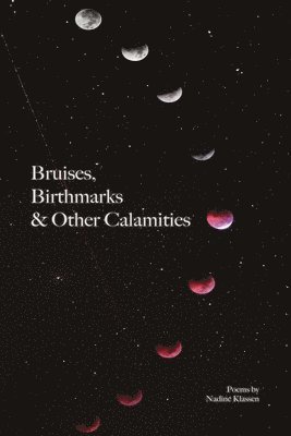 Bruises, Birthmarks & Other Calamities 1