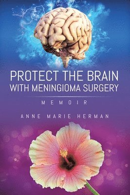 Protect the Brain with Meningioma Surgery 1