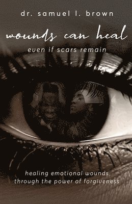 Wounds Can Heal, Even If Scars Remain