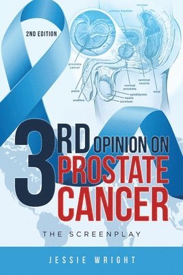 bokomslag 3rd Opinion on Prostate Cancer