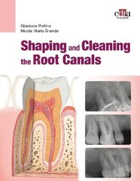 bokomslag Shaping and Cleaning the Root Canal System