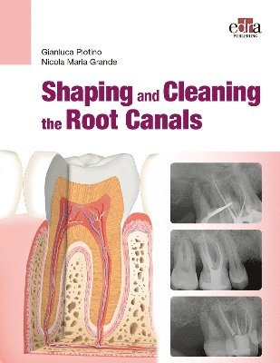 Shaping and Cleaning the Root Canal System 1