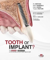 bokomslag Tooth or Implant