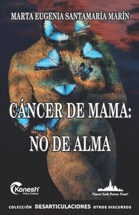 bokomslag Cáncer de mama