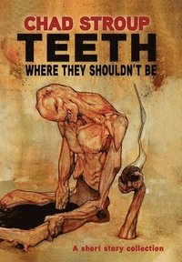 bokomslag Teeth Where They Shouldn't Be