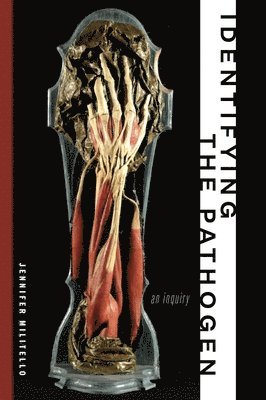 Identifying the Pathogen