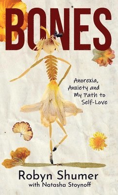 Bones 1