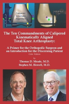 The Ten Commandments of Calipered Kinematically Aligned Total Knee Arthroplasty 1