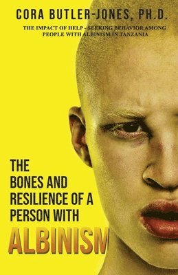 bokomslag The Bones and Resilience of a Person with Albinism