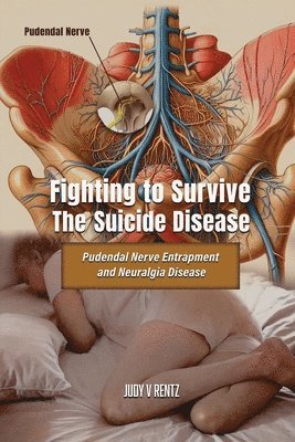Judy V. Rentz, Judy V Rentz - Fighting to Survive The Suicide Disease: Pudendal Nerve Entrapment and Neuralgia Disease, Häftad