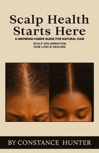 bokomslag Scalp Health Starts Here: From Root to Tip: a Growing Hands Guide for Natural Hair