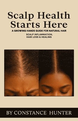 bokomslag Scalp Health Starts Here