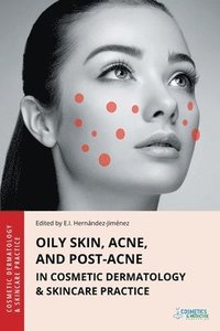 bokomslag Oily Skin, Acne, and Post-Acne in Cosmetic Dermatology & Skincare Practice
