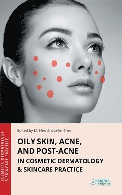 bokomslag Oily Skin, Acne, and Post-Acne in Cosmetic Dermatology & Skincare Practice