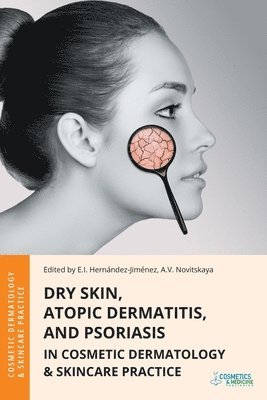 bokomslag Dry Skin, Atopic Dermatitis, and Psoriasis in Cosmetic Dermatology & Skincare Practice