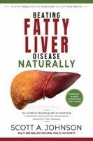 Scott A Johnson - Beating Fatty Liver Disease Naturally, Häftad. Tillgänglighet: Lägg i varukorg