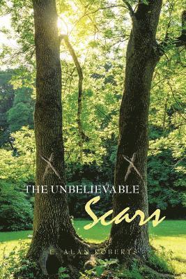 Unbelievable Scars 1