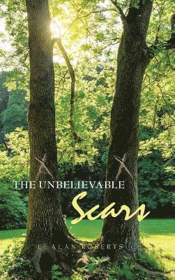 Unbelievable Scars 1