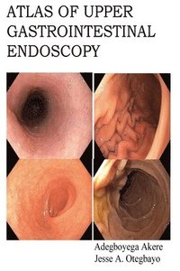 bokomslag Atlas of Upper Gastrointestinal Endoscopy
