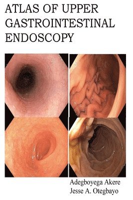 Atlas of Upper Gastrointestinal Endoscopy 1