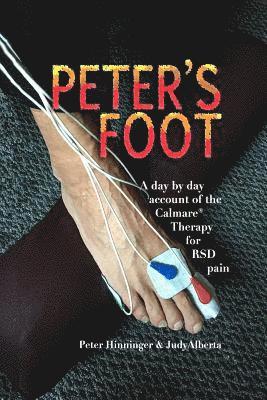 Peter M. Hinninger, Judy M. Alberta - Peter's Foot: Calmare Treatment for RSD Pain Relief, Häftad
