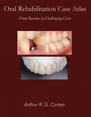 Oral Rehabilitation Case Atlas: From Routine to Challenging Cases 1