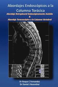 bokomslag Abordajes Endoscopicos a la Columna Toracica: Abordaje retropleural endoscopicamente asistido & Abordaje toracoscopico a la columna vertebral