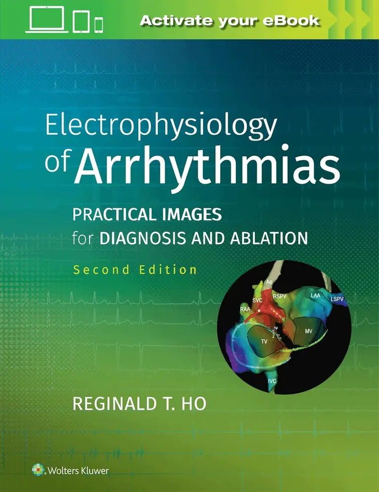 Reginald T. Ho - Electrophysiology of Arrhythmias, Inbunden. Tillgänglighet: Lägg i varukorg