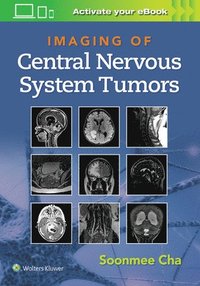 bokomslag Imaging of Central Nervous System Tumors