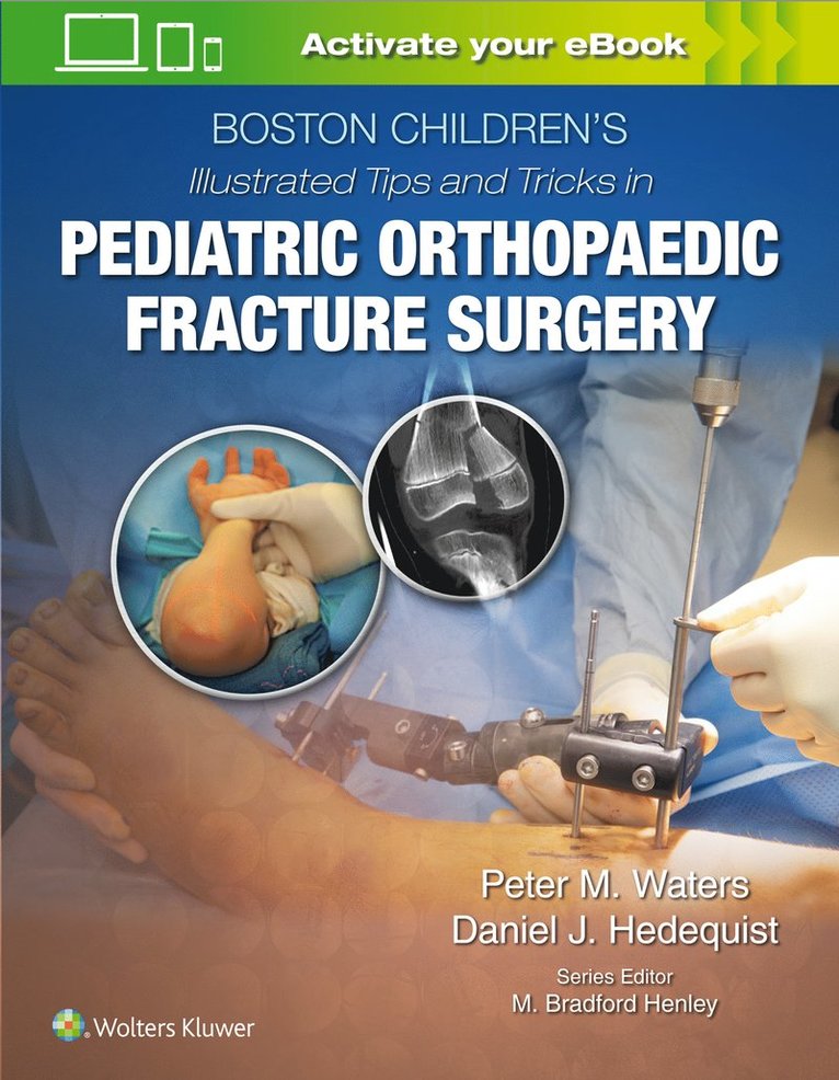 Peter M Waters, Daniel Hedequist, MD Waters, Peter M, Peter M. Waters - Boston Children’s Illustrated Tips and Tricks  in Pediatric Orthopaedic Fracture Surgery, Inbunden