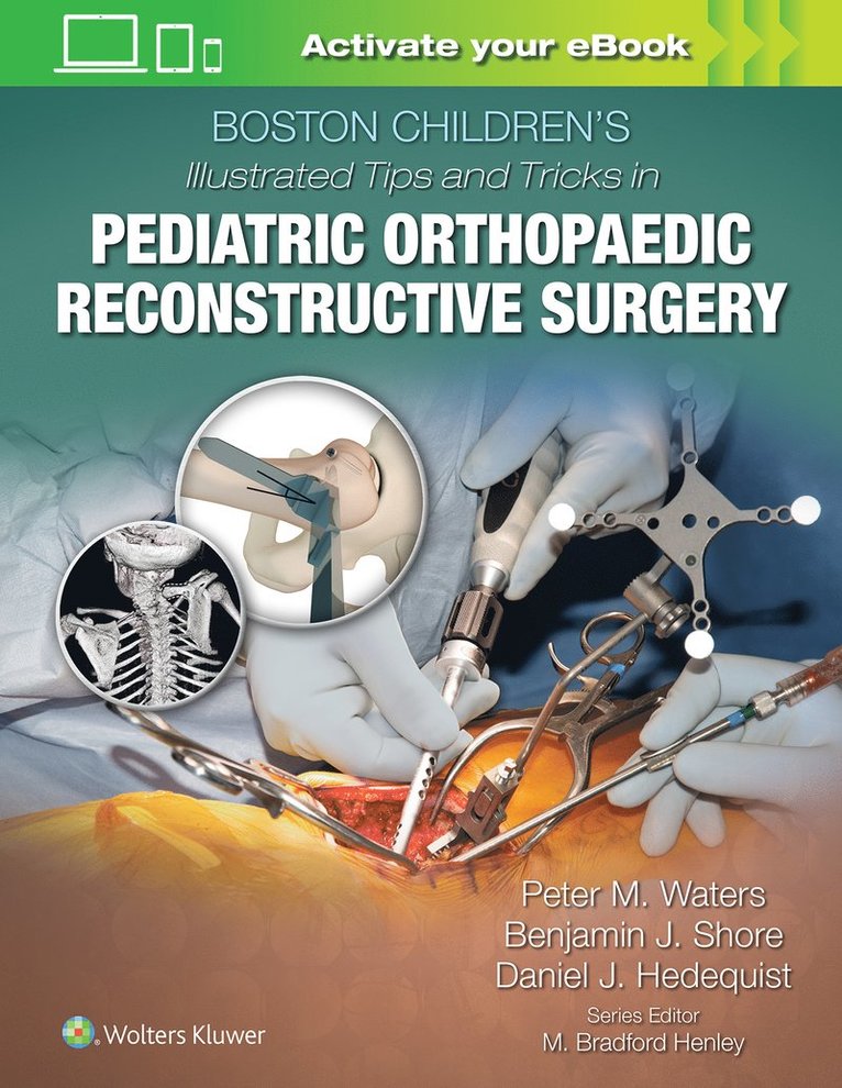 Peter M Waters, MD Waters, Peter M, Peter M. Waters - Boston Children's Illustrated Tips and Tricks in Pediatric Orthopaedic Reconstructive Surgery, Inbunden