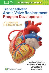 bokomslag Transcatheter Aortic Valve Replacement Program Development