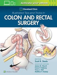 bokomslag Cleveland Clinic Illustrated Tips and Tricks in Colon and Rectal Surgery