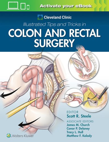 bokomslag Cleveland Clinic Illustrated Tips and Tricks in Colon and Rectal Surgery